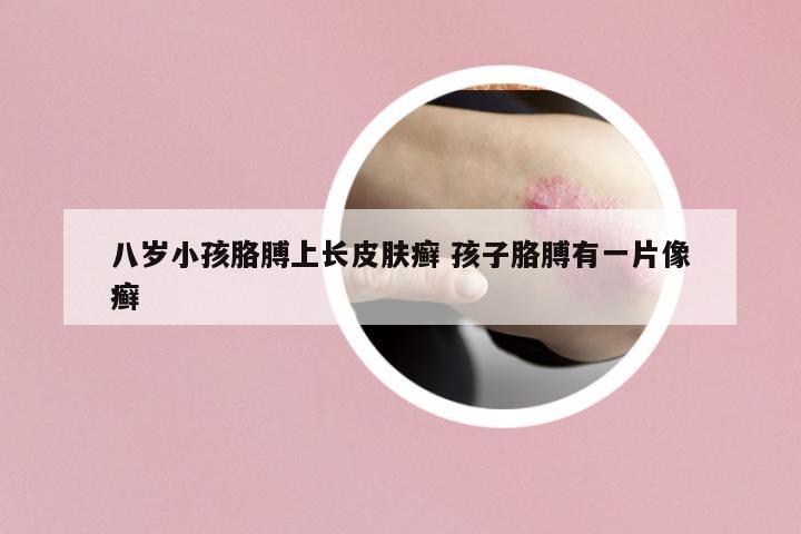 八歲小孩胳膊上長皮膚癬 孩子胳膊有一片像癬