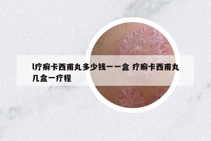 l療癬卡西甫丸多少錢一一盒 療癬卡西甫丸幾盒一療程