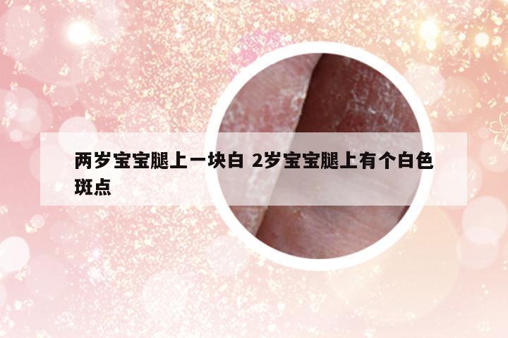 兩歲寶寶腿上一塊白 2歲寶寶腿上有個白色斑點