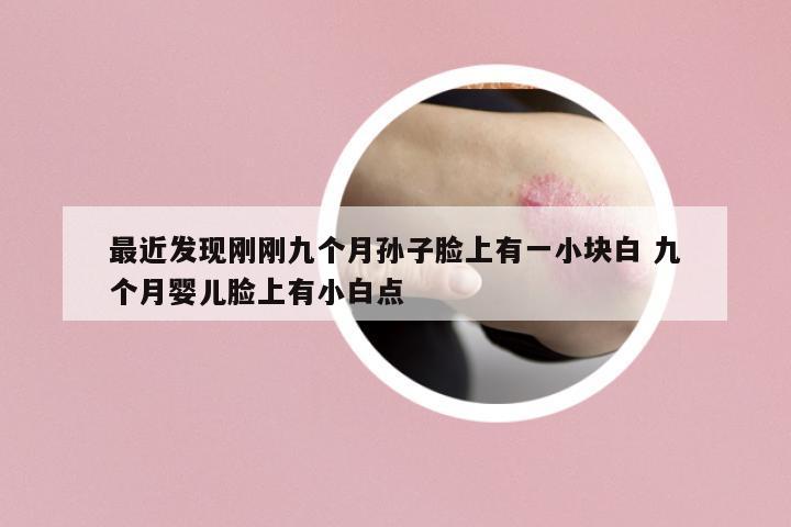 最近發(fā)現(xiàn)剛剛九個(gè)月孫子臉上有一小塊白 九個(gè)月嬰兒臉上有小白點(diǎn)