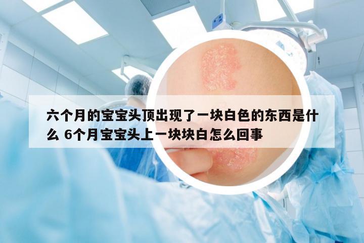 六個月的寶寶頭頂出現(xiàn)了一塊白色的東西是什么 6個月寶寶頭上一塊塊白怎么回事