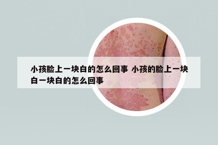 小孩臉上一塊白的怎么回事 小孩的臉上一塊白一塊白的怎么回事