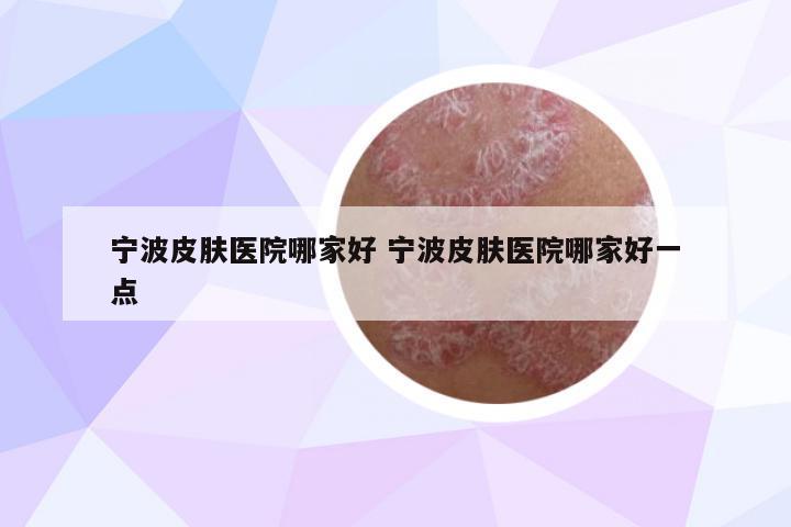 寧波皮膚醫(yī)院哪家好 寧波皮膚醫(yī)院哪家好一點(diǎn)