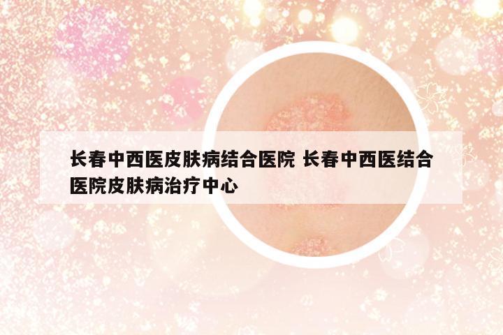 長(zhǎng)春中西醫(yī)皮膚病結(jié)合醫(yī)院 長(zhǎng)春中西醫(yī)結(jié)合醫(yī)院皮膚病治療中心