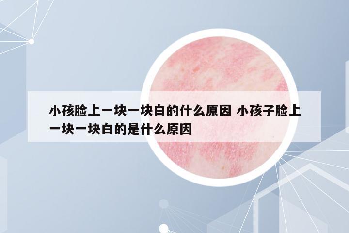 小孩臉上一塊一塊白的什么原因 小孩子臉上一塊一塊白的是什么原因