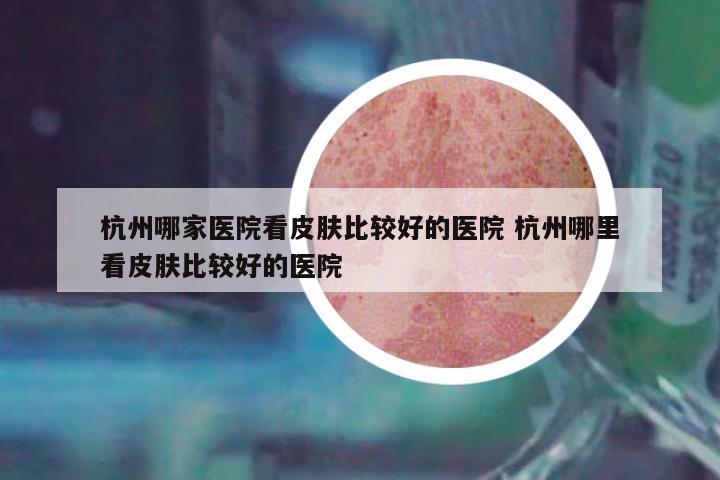 杭州哪家醫(yī)院看皮膚比較好的醫(yī)院 杭州哪里看皮膚比較好的醫(yī)院