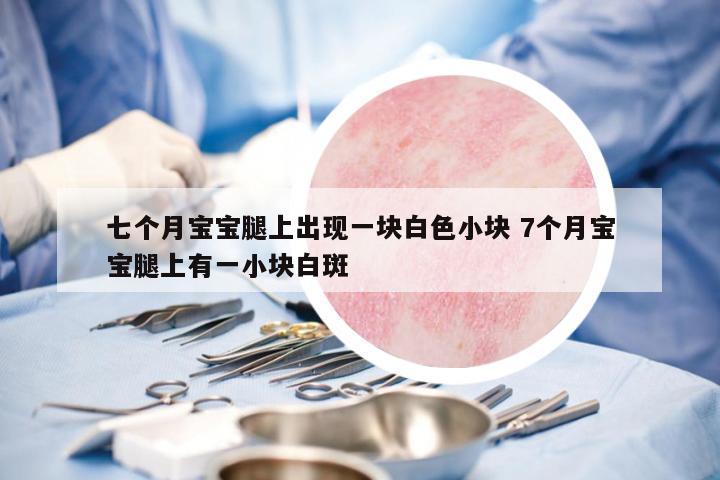 七個(gè)月寶寶腿上出現(xiàn)一塊白色小塊 7個(gè)月寶寶腿上有一小塊白斑