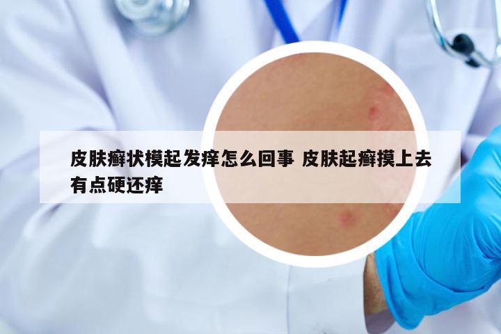 皮膚癬狀模起發(fā)癢怎么回事 皮膚起癬摸上去有點硬還癢