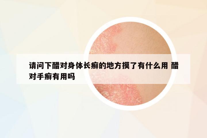 請(qǐng)問下醋對(duì)身體長(zhǎng)癬的地方摸了有什么用 醋對(duì)手癬有用嗎