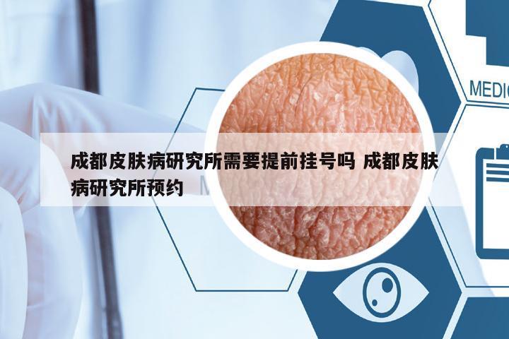 成都皮膚病研究所需要提前掛號(hào)嗎 成都皮膚病研究所預(yù)約