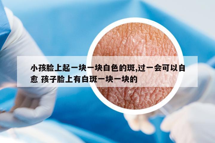 小孩臉上起一塊一塊白色的斑,過一會可以自愈 孩子臉上有白斑一塊一塊的