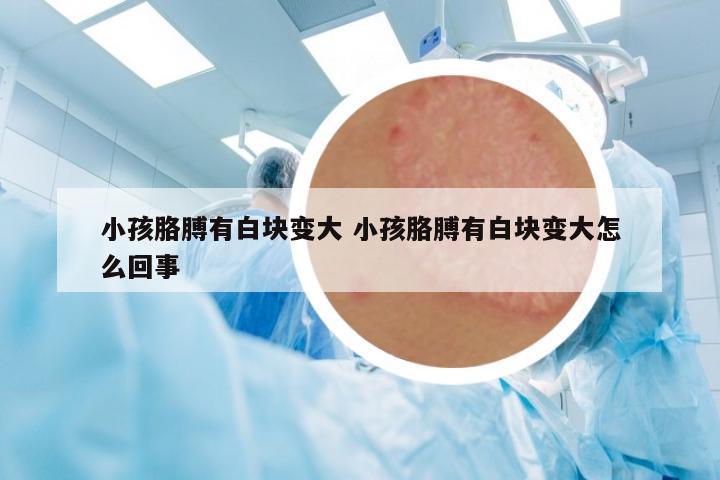 小孩胳膊有白塊變大 小孩胳膊有白塊變大怎么回事