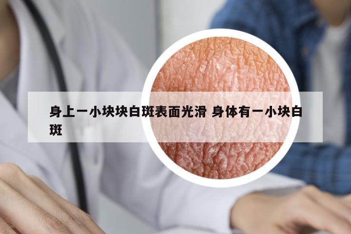 身上一小塊塊白斑表面光滑 身體有一小塊白斑