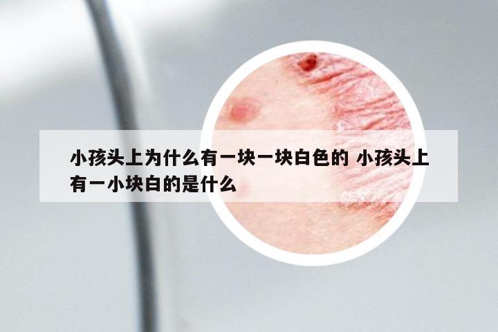 小孩頭上為什么有一塊一塊白色的 小孩頭上有一小塊白的是什么