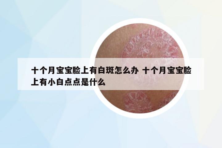 十個(gè)月寶寶臉上有白斑怎么辦 十個(gè)月寶寶臉上有小白點(diǎn)點(diǎn)是什么