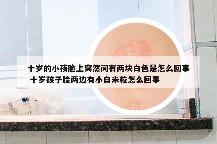 十歲的小孩臉上突然間有兩塊白色是怎么回事 十歲孩子臉兩邊有小白米粒怎么回事