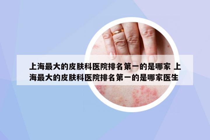 上海最大的皮膚科醫(yī)院排名第一的是哪家 上海最大的皮膚科醫(yī)院排名第一的是哪家醫(yī)生