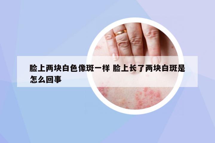 臉上兩塊白色像斑一樣 臉上長了兩塊白斑是怎么回事
