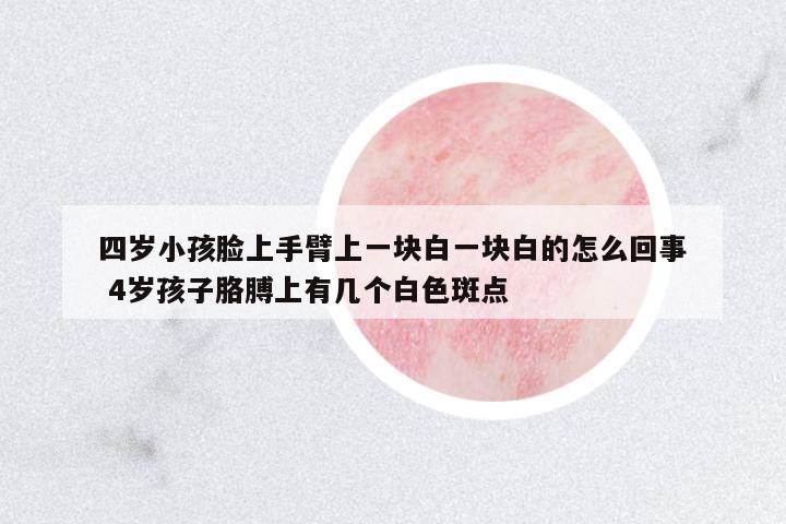 四歲小孩臉上手臂上一塊白一塊白的怎么回事 4歲孩子胳膊上有幾個(gè)白色斑點(diǎn)