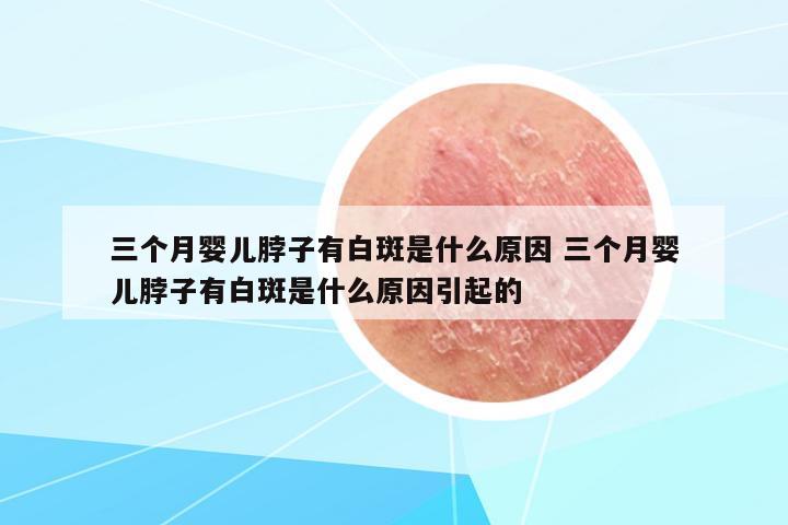 三個(gè)月嬰兒脖子有白斑是什么原因 三個(gè)月嬰兒脖子有白斑是什么原因引起的