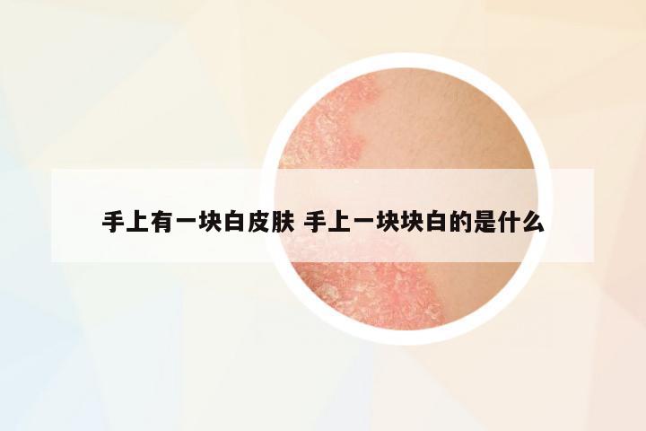 手上有一塊白皮膚 手上一塊塊白的是什么