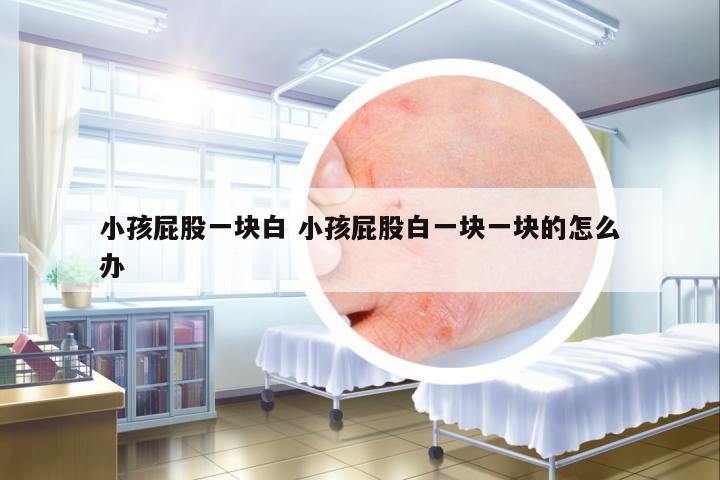 小孩屁股一塊白 小孩屁股白一塊一塊的怎么辦