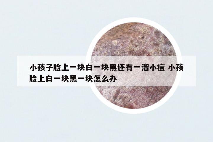 小孩子臉上一塊白一塊黑還有一溜小痘 小孩臉上白一塊黑一塊怎么辦
