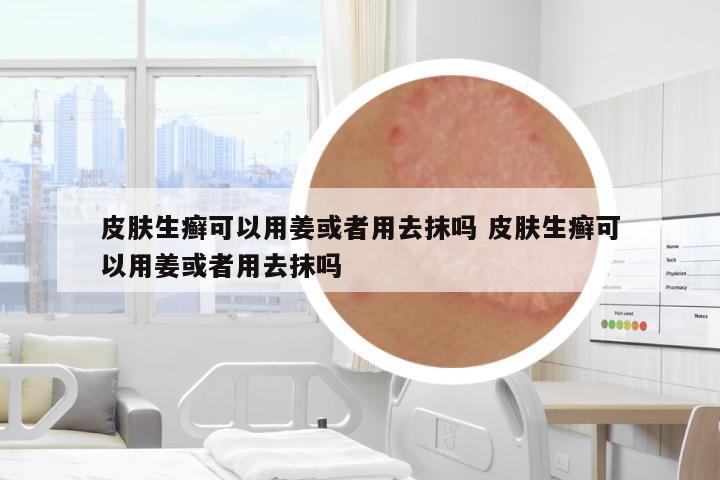 皮膚生癬可以用姜或者用去抹嗎 皮膚生癬可以用姜或者用去抹嗎