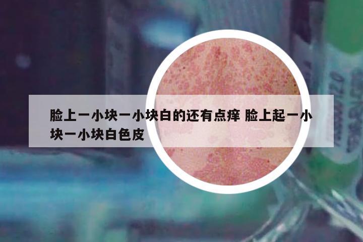 臉上一小塊一小塊白的還有點癢 臉上起一小塊一小塊白色皮