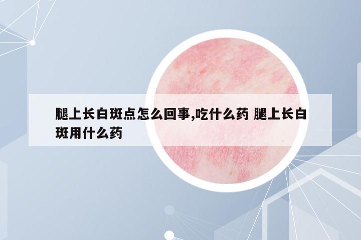 腿上長(zhǎng)白斑點(diǎn)怎么回事,吃什么藥 腿上長(zhǎng)白斑用什么藥