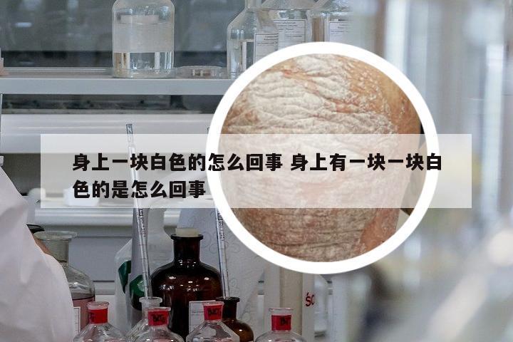 身上一塊白色的怎么回事 身上有一塊一塊白色的是怎么回事