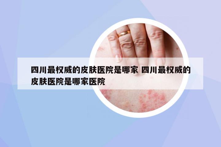 四川最權(quán)威的皮膚醫(yī)院是哪家 四川最權(quán)威的皮膚醫(yī)院是哪家醫(yī)院