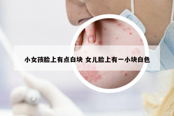 小女孩臉上有點(diǎn)白塊 女兒臉上有一小塊白色