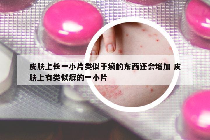 皮膚上長一小片類似于癬的東西還會增加 皮膚上有類似癬的一小片
