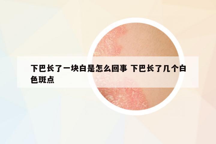 下巴長了一塊白是怎么回事 下巴長了幾個(gè)白色斑點(diǎn)