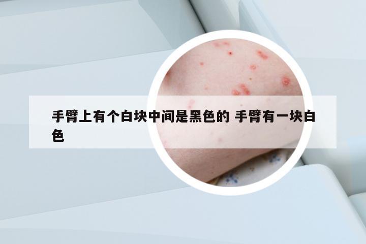 手臂上有個(gè)白塊中間是黑色的 手臂有一塊白色