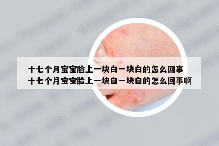 十七個月寶寶臉上一塊白一塊白的怎么回事 十七個月寶寶臉上一塊白一塊白的怎么回事啊