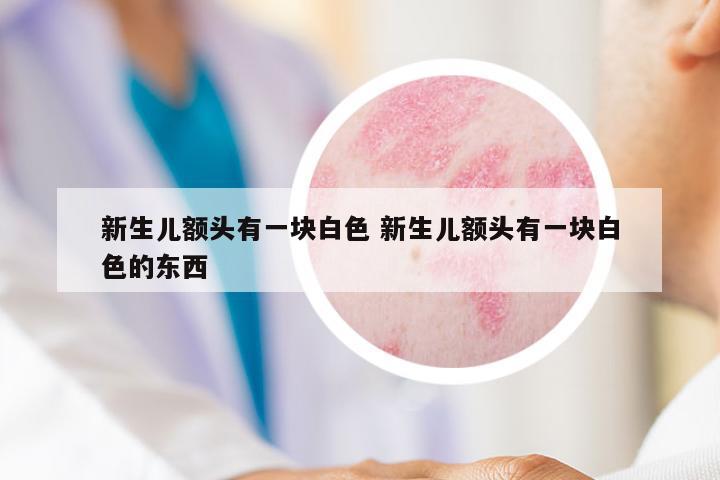 新生兒額頭有一塊白色 新生兒額頭有一塊白色的東西