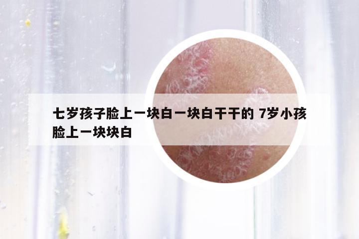七歲孩子臉上一塊白一塊白干干的 7歲小孩臉上一塊塊白