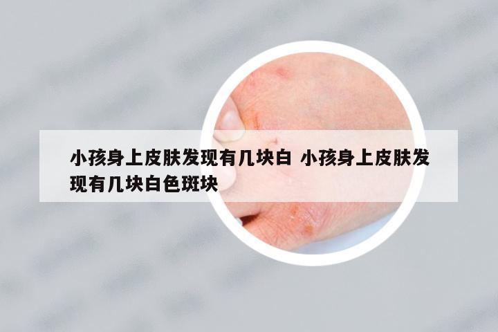 小孩身上皮膚發(fā)現(xiàn)有幾塊白 小孩身上皮膚發(fā)現(xiàn)有幾塊白色斑塊