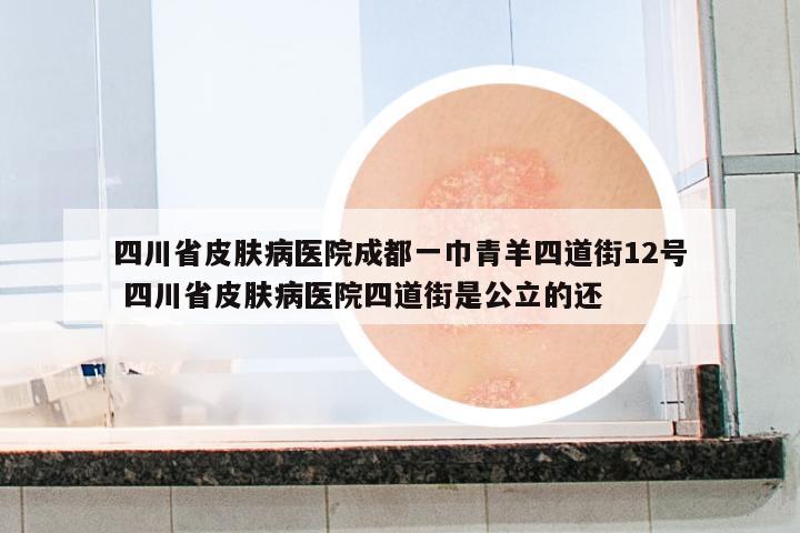 四川省皮膚病醫(yī)院成都一巾青羊四道街12號 四川省皮膚病醫(yī)院四道街是公立的還