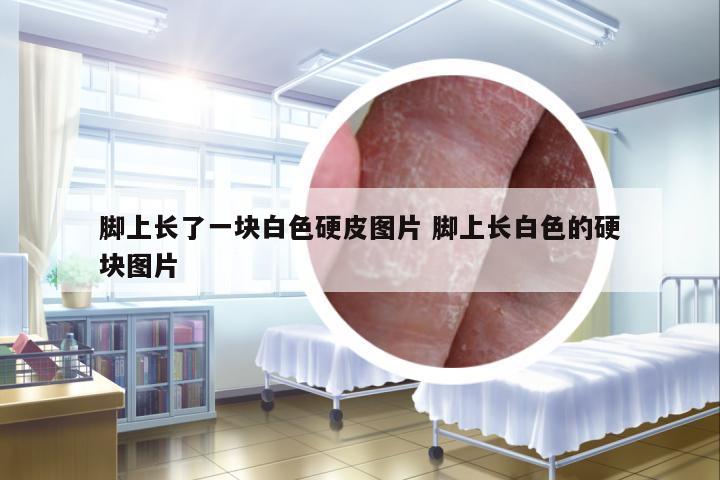 腳上長(zhǎng)了一塊白色硬皮圖片 腳上長(zhǎng)白色的硬塊圖片