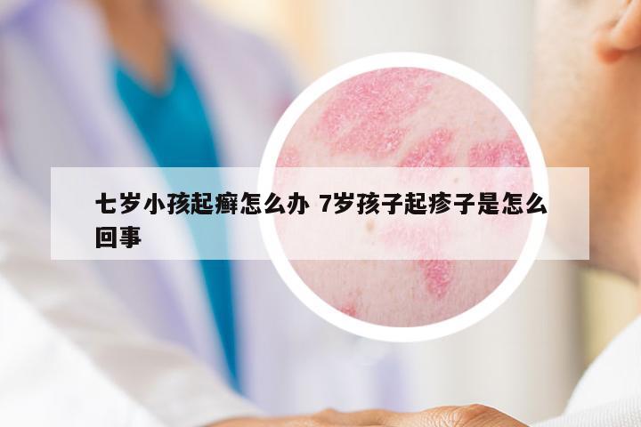 七歲小孩起癬怎么辦 7歲孩子起疹子是怎么回事