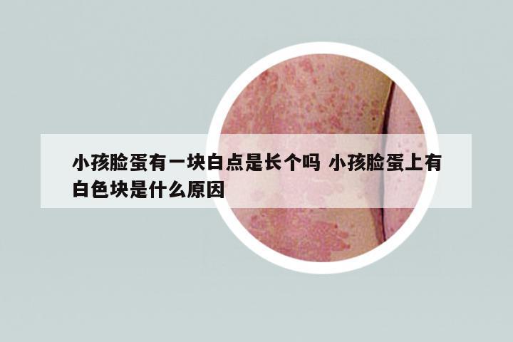 小孩臉蛋有一塊白點(diǎn)是長(zhǎng)個(gè)嗎 小孩臉蛋上有白色塊是什么原因