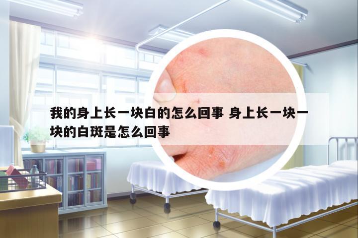 我的身上長一塊白的怎么回事 身上長一塊一塊的白斑是怎么回事