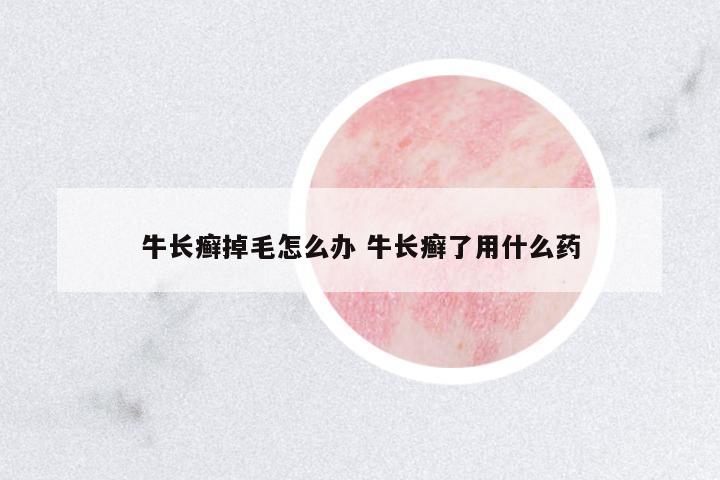 牛長(zhǎng)癬掉毛怎么辦 牛長(zhǎng)癬了用什么藥