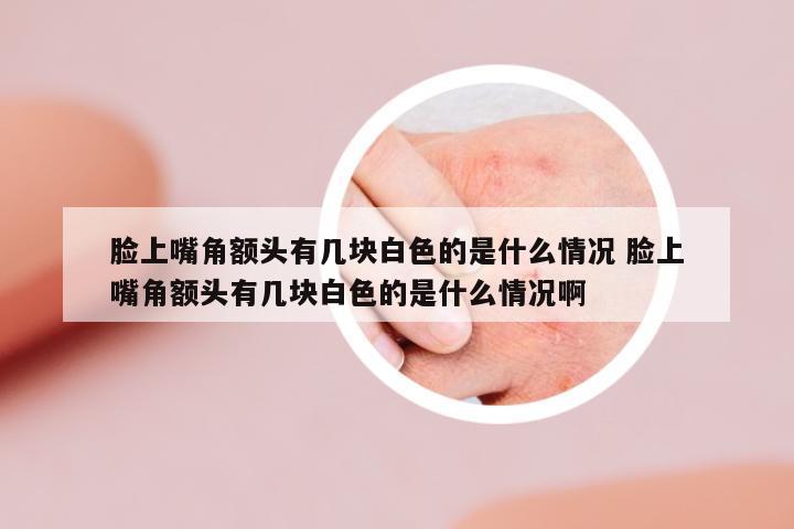 臉上嘴角額頭有幾塊白色的是什么情況 臉上嘴角額頭有幾塊白色的是什么情況啊