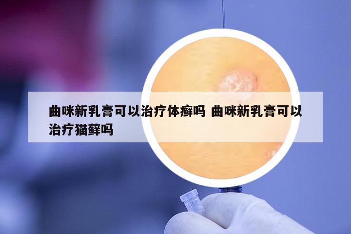 曲咪新乳膏可以治療體癬嗎 曲咪新乳膏可以治療貓?zhí)\嗎
