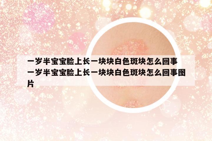 一歲半寶寶臉上長一塊塊白色斑塊怎么回事 一歲半寶寶臉上長一塊塊白色斑塊怎么回事圖片