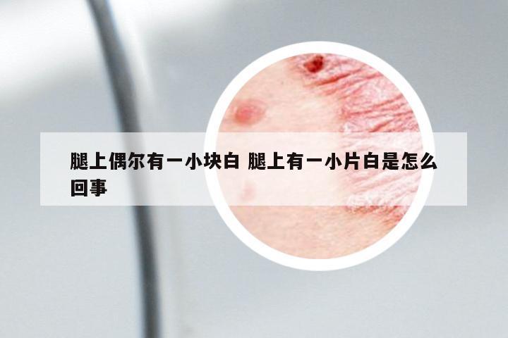 腿上偶爾有一小塊白 腿上有一小片白是怎么回事